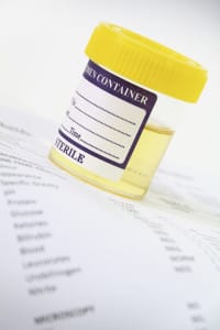 drug monitoring urine sample