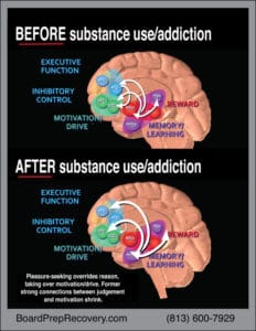 infographic showing brain before and after substance abuse