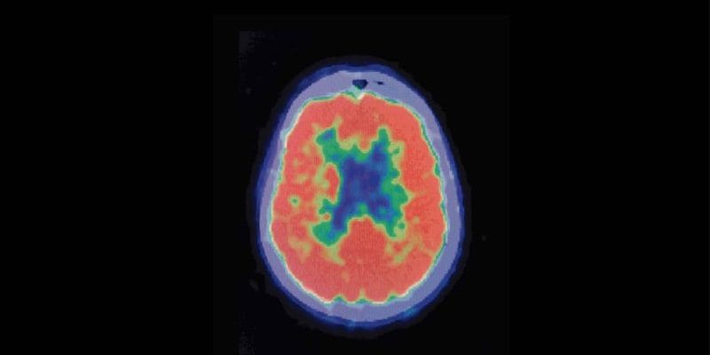 brain science with BoardPrep
