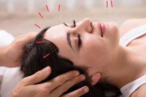 Woman getting acupuncture done at an acupuncture, acupressure and massage program